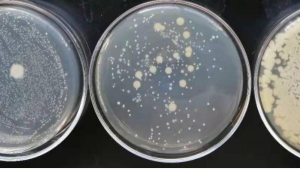 菌落總數(shù)檢測(cè)常見問題分析